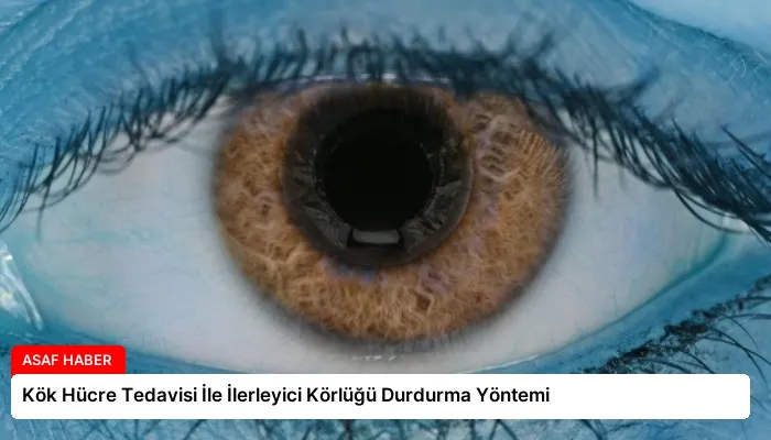 Kök Hücre Tedavisi İle İlerleyici Körlüğü Durdurma Yöntemi