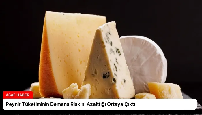 Peynir Tüketiminin Demans Riskini Azalttığı Ortaya Çıktı