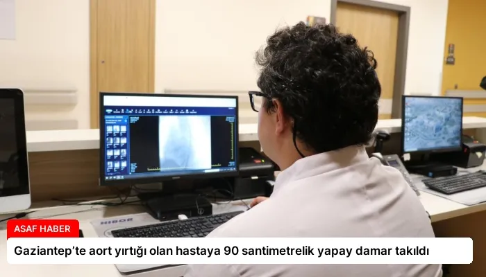 Gaziantep’te aort yırtığı olan hastaya 90 santimetrelik yapay damar takıldı