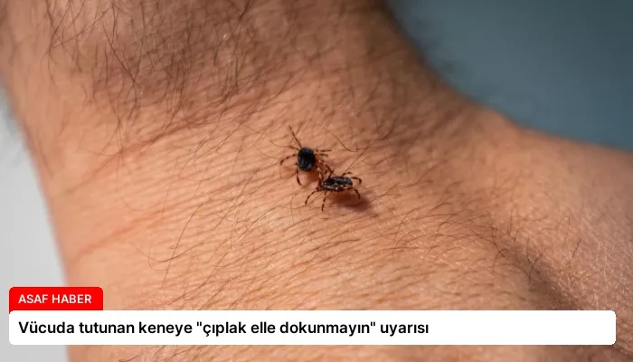 Vücuda tutunan keneye “çıplak elle dokunmayın” uyarısı
